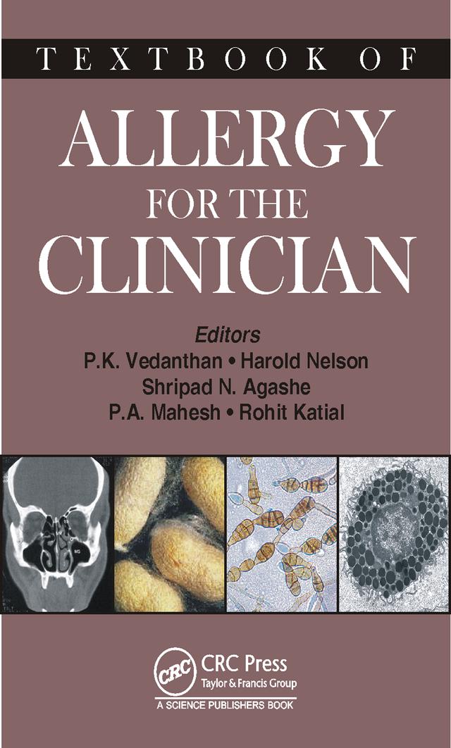 Textbook of Allergy for the Clinician by Harold S. Nelson, Mahesh P A, Pudupakkam K. Vedanthan, Rohit Katial, Shripad N. Agashe