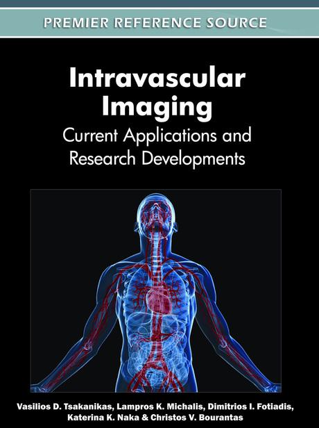 Intravascular Imaging: Current Applications and Research Developments by Christos V. Bourantas, Dimitrios I. Fotiadis, Katerina K. Naka, Lampros K. Michalis, Vasilios D. Tsakanikas