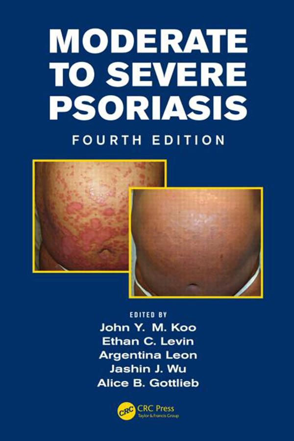 Mild to Moderate and Moderate to Severe Psoriasis (Set) by Argentina Leon, Ethan Levin, Jashin Wu, John Koo