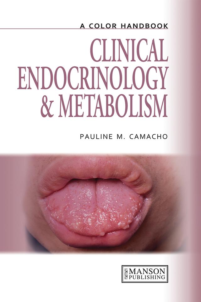 Clinical Endocrinology and Metabolism by Pauline Camacho