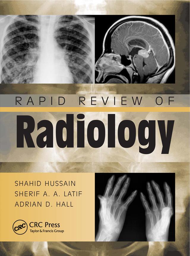 Rapid Review of Radiology by Adrian David Hall, Shahid Hussain, Sherif Aaron Abdel Latif