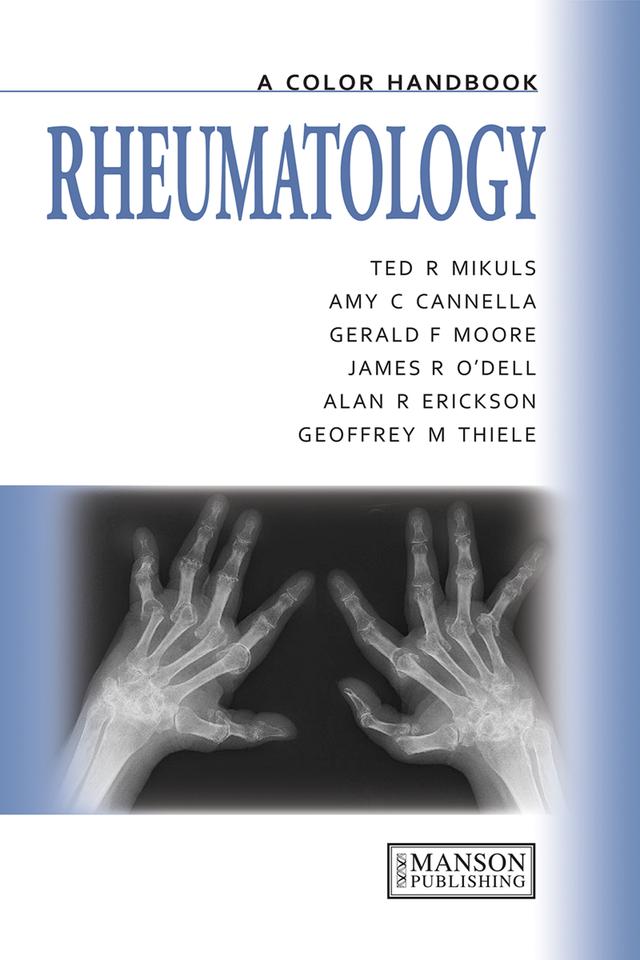 Rheumatology by Alan Erikson, Amy Cannella, Geoffrey Thiele, Gerald Moore, James O'Dell, Ted Mikuls
