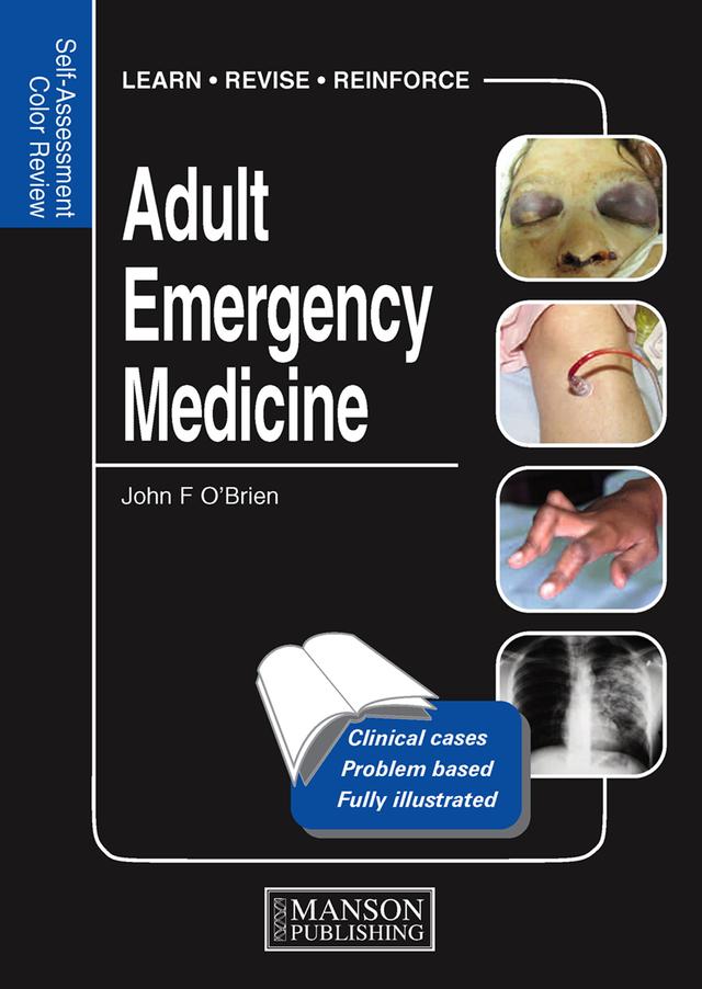 Adult Emergency Medicine by John O'Brien