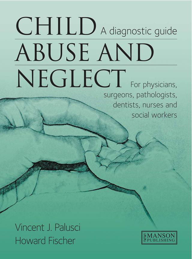 Child Abuse & Neglect by Howard Fischer, Vincent Palusci