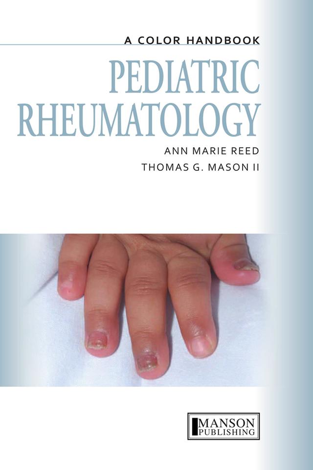 Pediatric Rheumatology by Anne Marie Reed, Thomas Mason