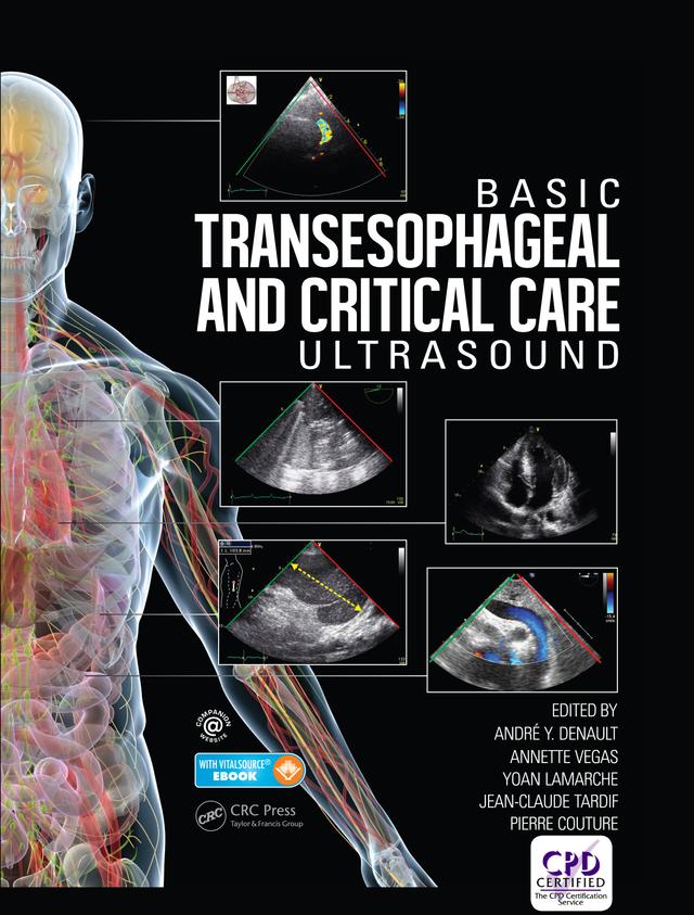 Basic Transesophageal and Critical Care Ultrasound by André Denault, Annette Vegas, Jean-Claude Tardif, Pierre Couture, Yoan Lamarche