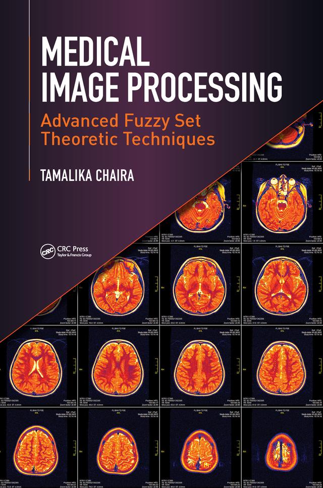 Medical Image Processing by Tamalika Chaira