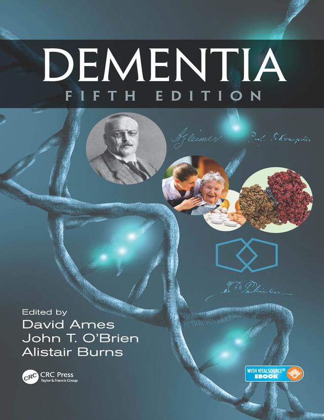 Dementia by Alistair Burns, David Ames, John T. O'Brien