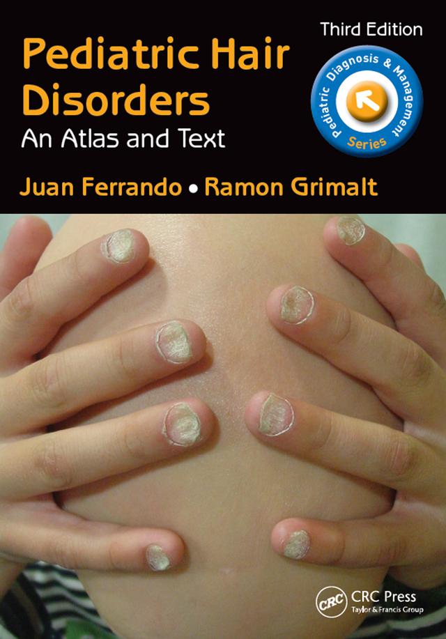 Pediatric Hair Disorders by Juan Ferrando, Ramon Grimalt