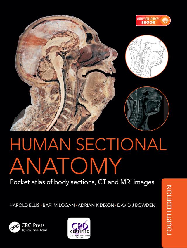 Human Sectional Anatomy by Adrian Kendal Dixon, Bari M. Logan, David J. Bowden, Harold Ellis