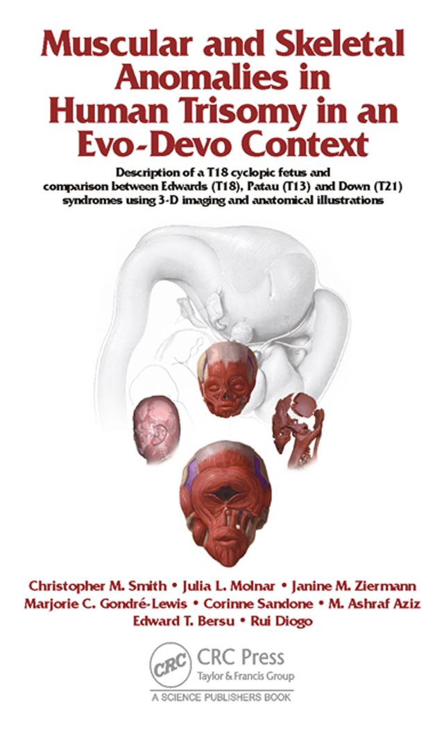 Muscular and Skeletal Anomalies in Human Trisomy in an Evo-Devo Context by Christopher M. Smith, Corinne Sandone, Edward T. Bersu, Janine M. Ziermann, Julia Molnar, Marjorie C. Gondre-Lewis, Mohammed Ashraf Aziz, Rui Diogo