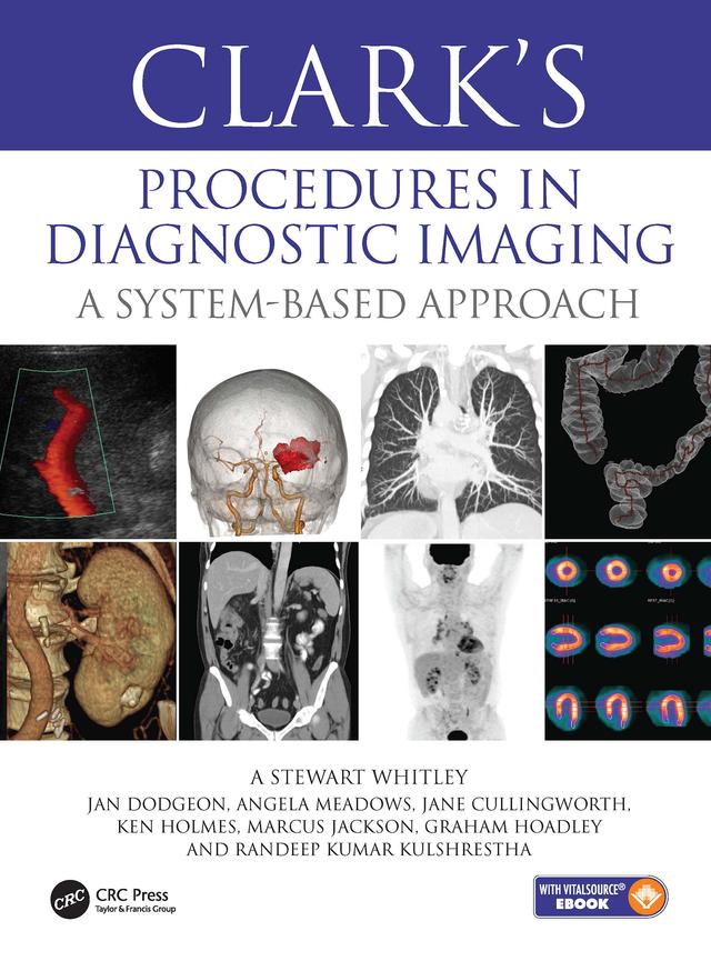 Clark’s Procedures in Diagnostic Imaging by Angela Meadows, A Stewart Whitley, Graham Hoadley, Jan Dodgeon, Jane Cullingworth, Ken Holmes, Marcus Jackson, Randeep Kulshrestha