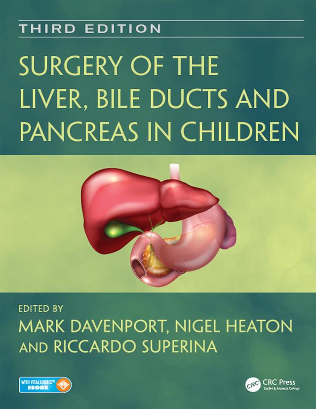 Surgery of the Liver, Bile Ducts and Pancreas in Children by Mark Davenport, Nigel Heaton, Riccardo Superina