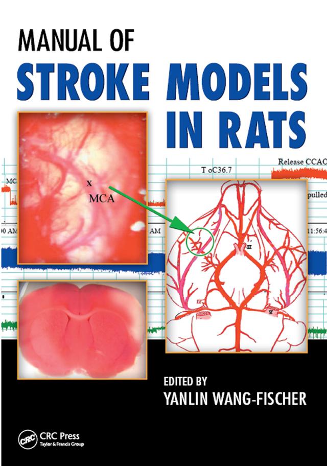 Manual of Stroke Models in Rats by Yanlin Wang-Fischer