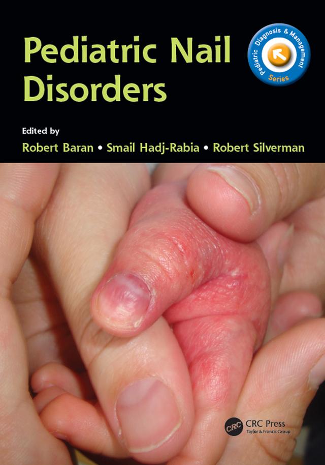 Pediatric Nail Disorders by Robert Baran, Robert Silverman, Smail Hadj-Rabia