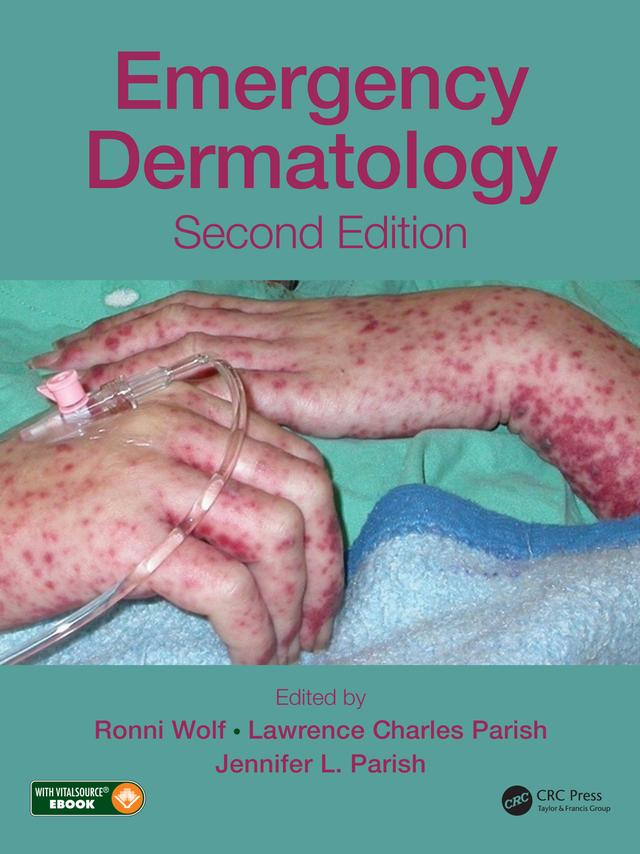 Emergency Dermatology by Jennifer L. Parish, Lawrence Charles Parish, Ronni Wolf