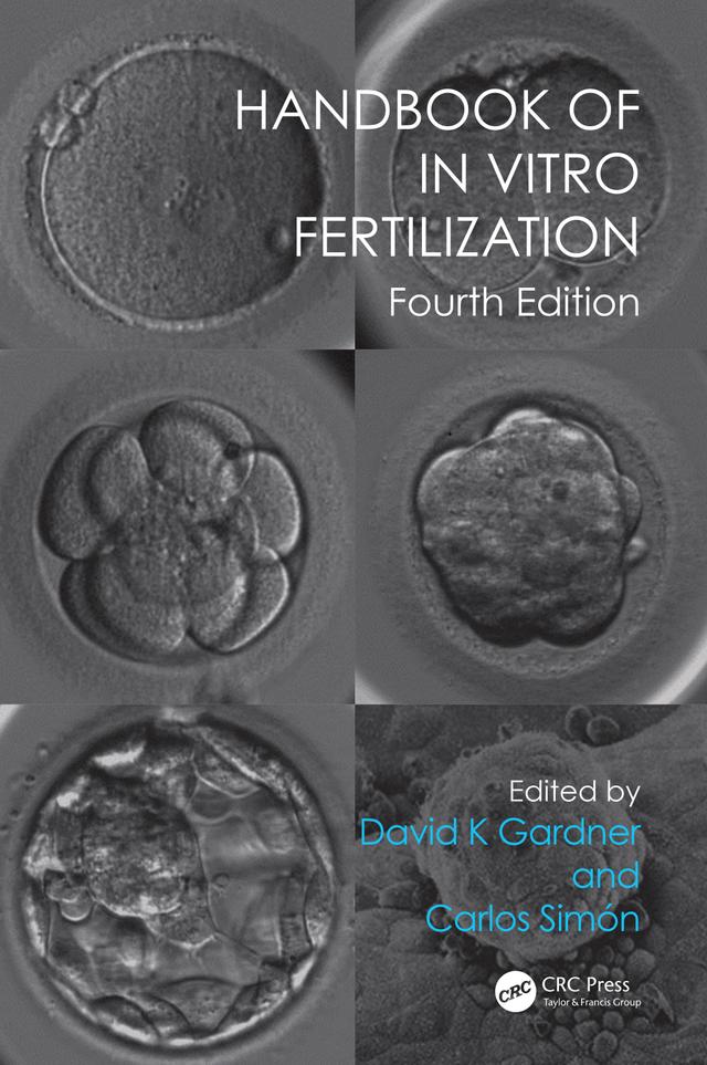 Handbook of In Vitro Fertilization by Carlos Simón, David K. Gardner