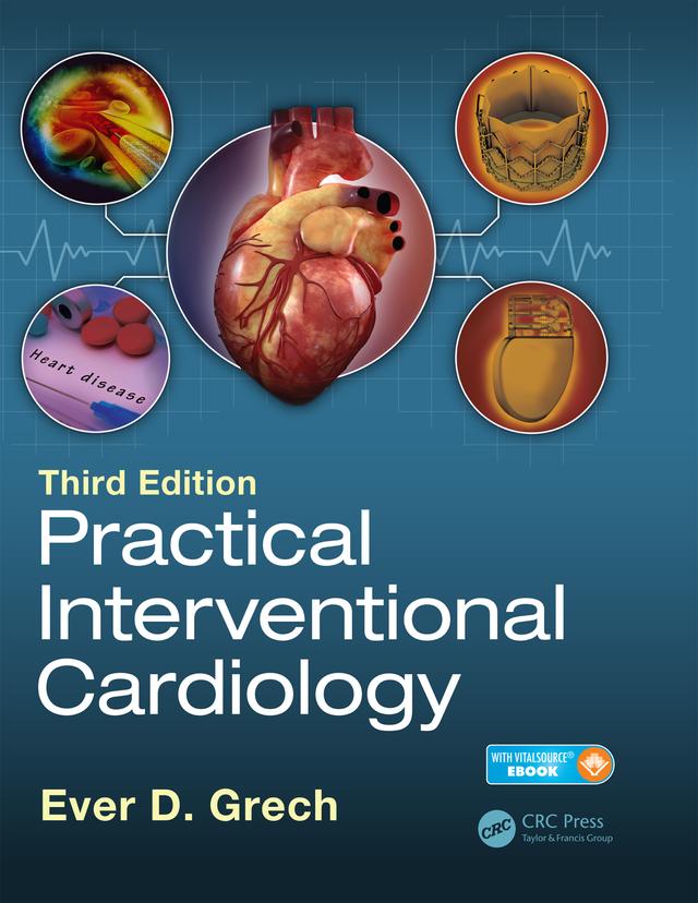 Practical Interventional Cardiology by Ever D. Grech