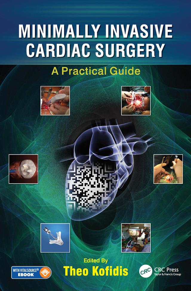 Minimally Invasive Cardiac Surgery by Theo Kofidis