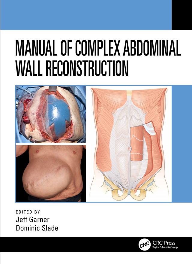 Manual of Complex Abdominal Wall Reconstruction by Dominic Slade, Jeff Garner