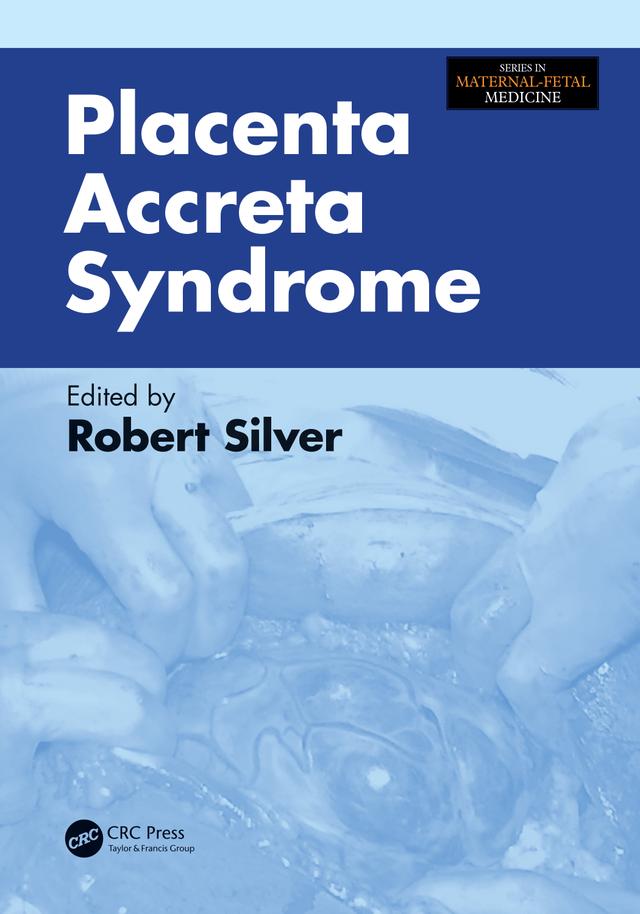 Placenta Accreta Syndrome by Robert Silver