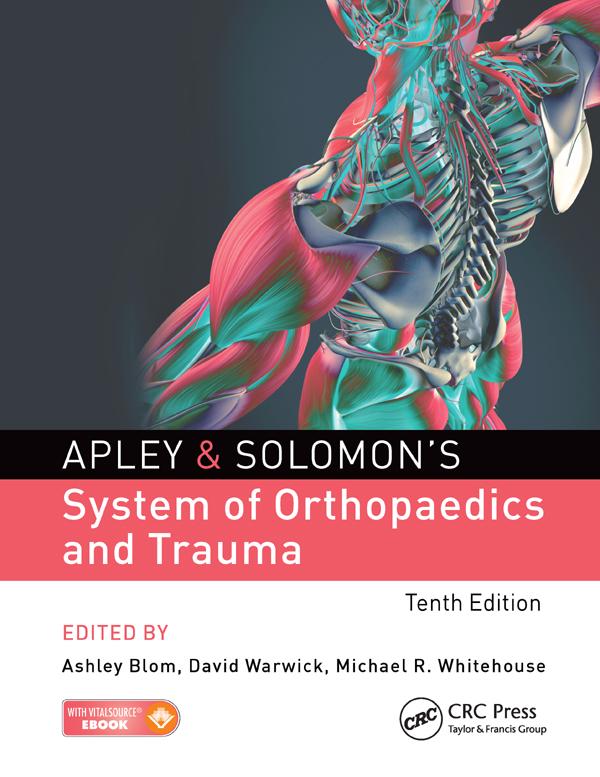 Apley & Solomon's System of Orthopaedics and Trauma by Ashley Blom, David Warwick, Michael Whitehouse