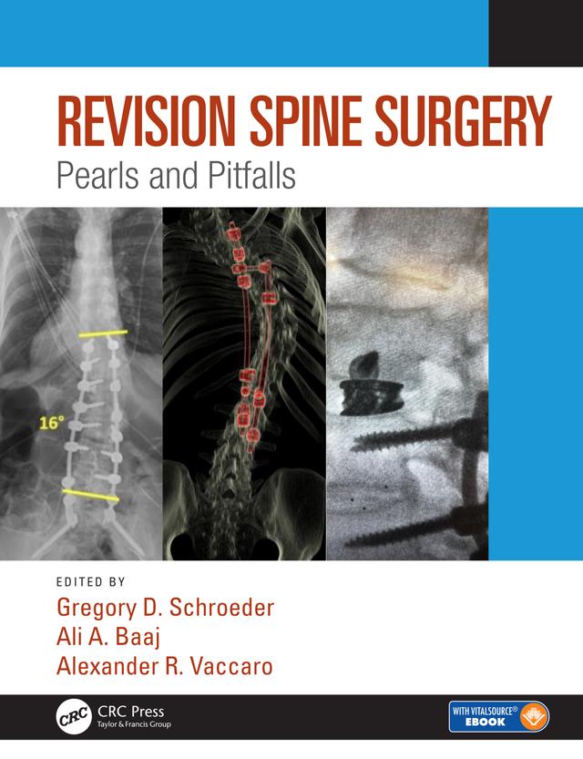 Revision Spine Surgery by Alexander R. Vaccaro, Ali A. Baaj, Gregory D. Schroeder