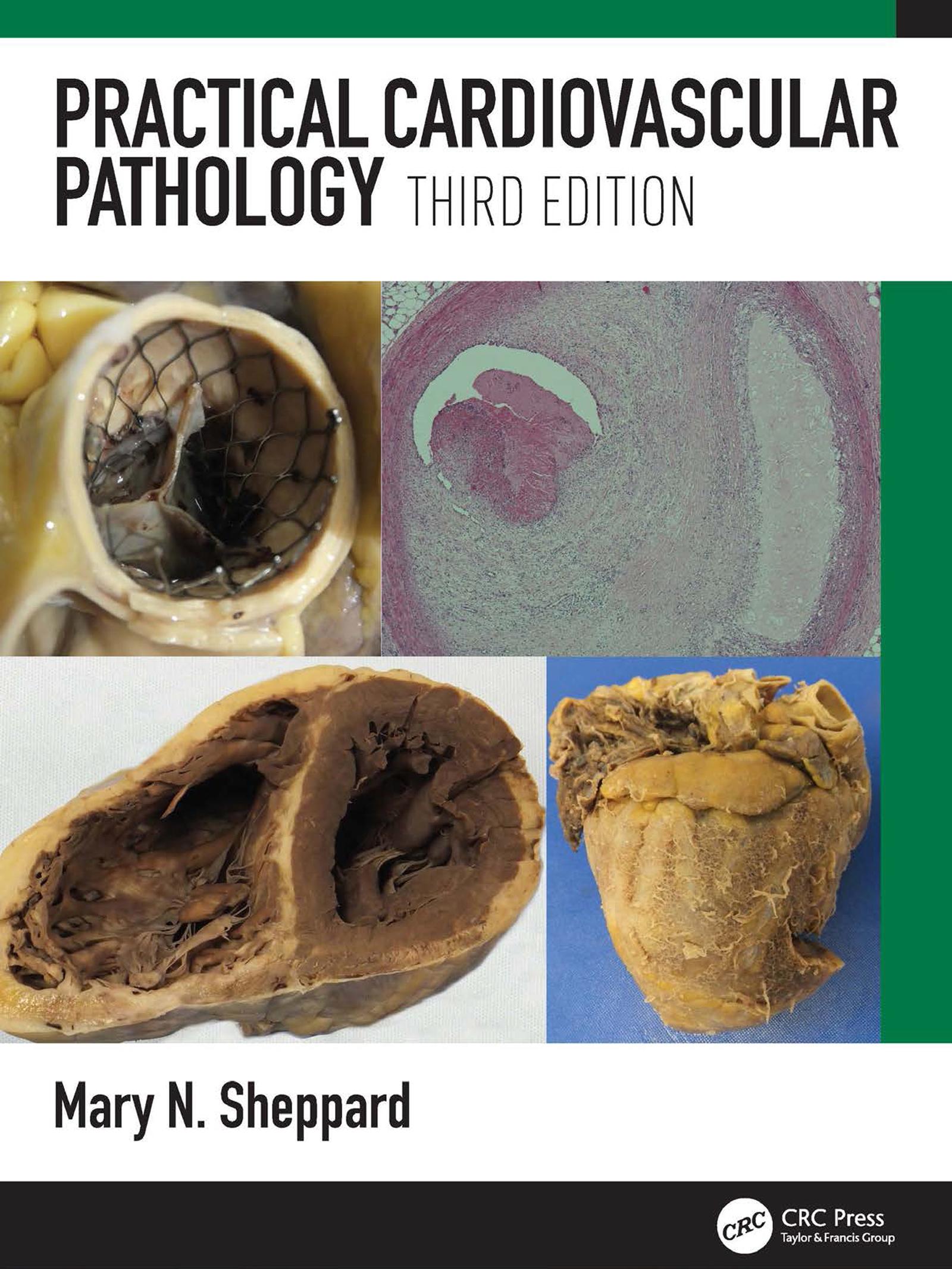 Practical Cardiovascular Pathology