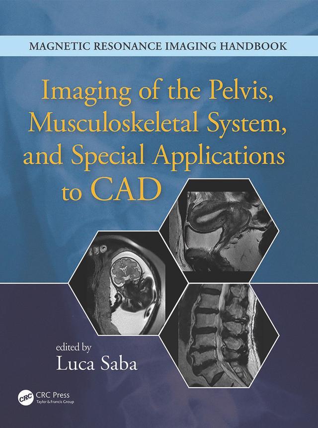 Imaging of the Pelvis, Musculoskeletal System, and Special Applications to CAD by Luca Saba