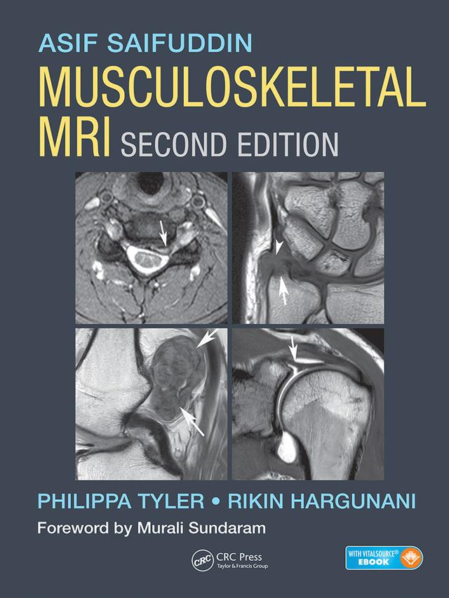 Musculoskeletal MRI by Asif Saifuddin, Philippa Tyler, Rikin Hargunani