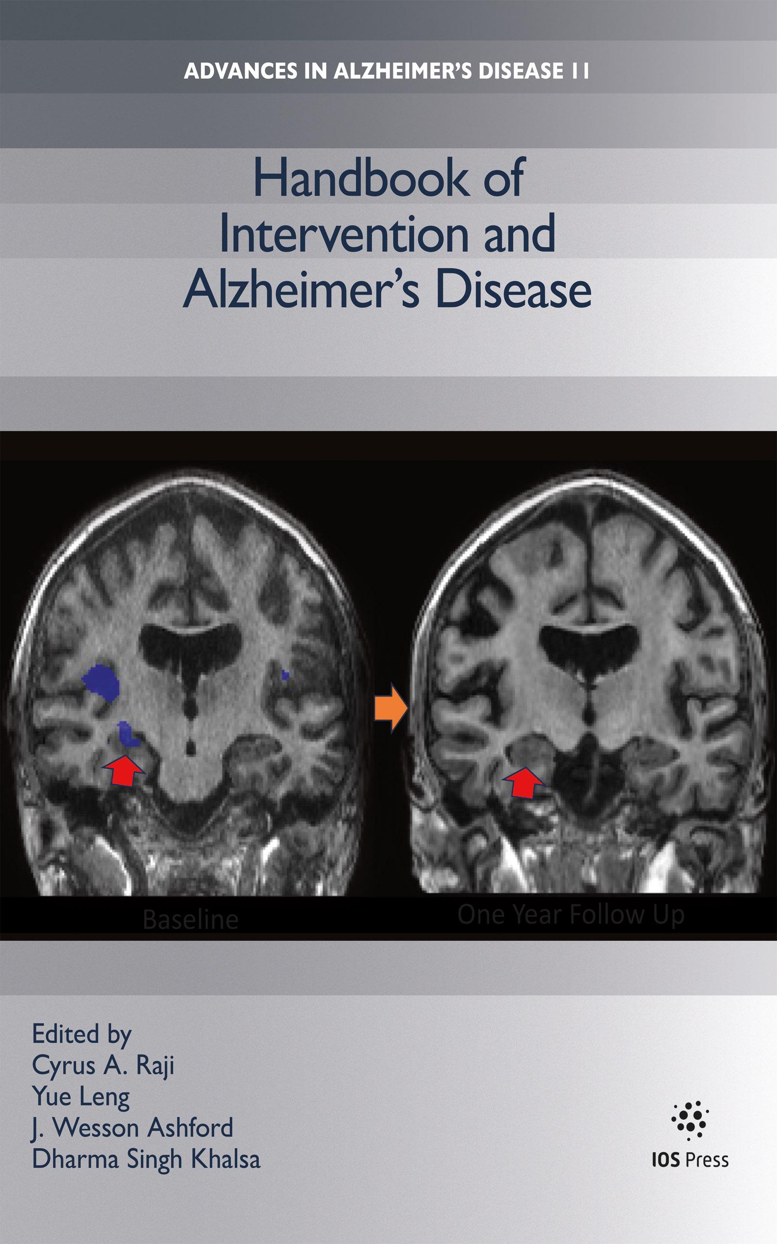 Handbook of Intervention and Alzheimer’s Disease