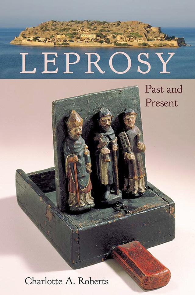 Leprosy by Charlotte A. Roberts