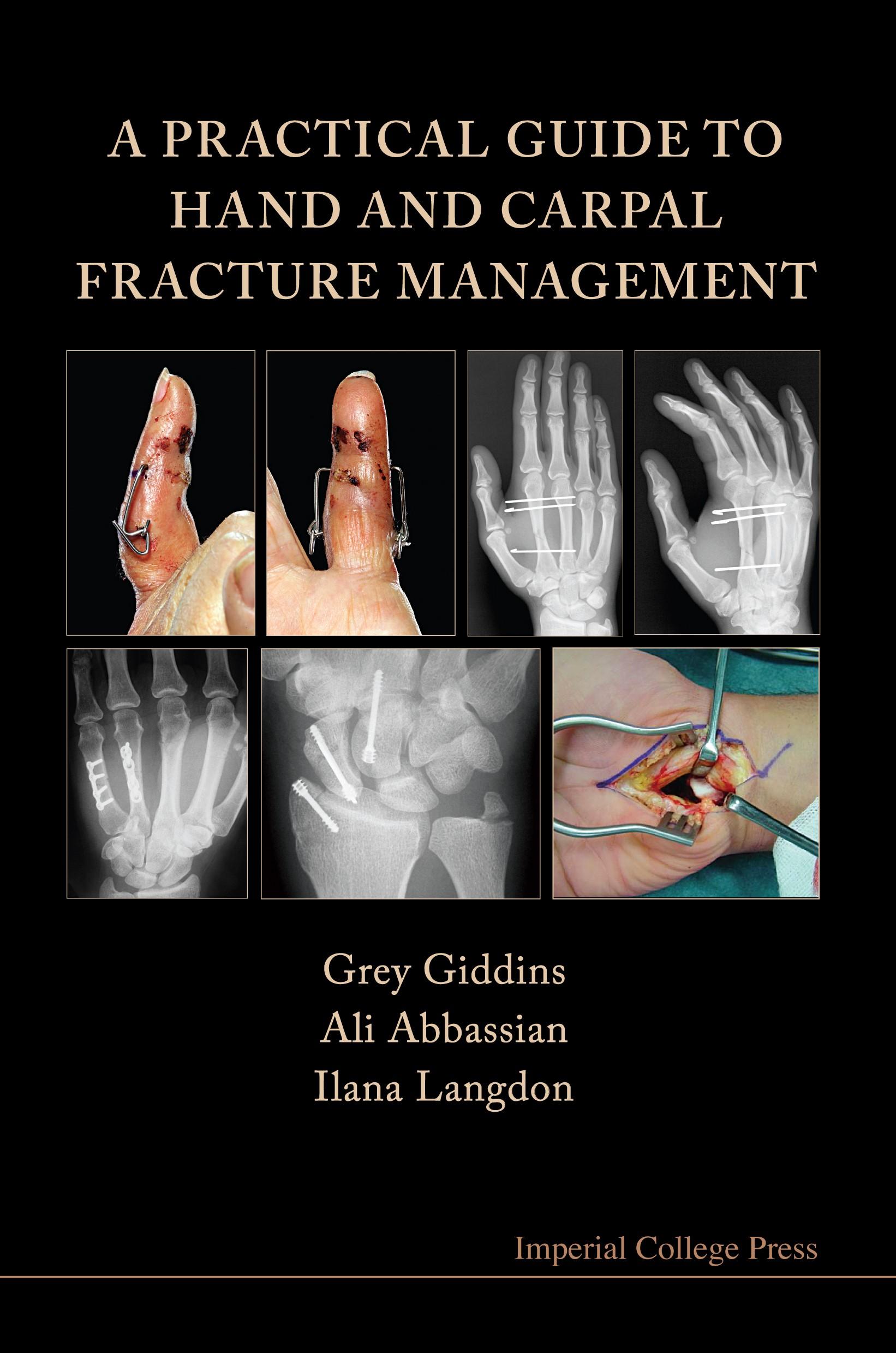 PRACTICAL GUIDE TO HAND & CARPAL FRAC, A