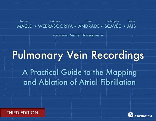 Pulmonary Vein Recordings : A Practical Guide to the Mapping and Ablation of Atrial Fibrillation Vol 3 by Jason Andrade, Laurent Macle, Rukshen WEERASOORIYA