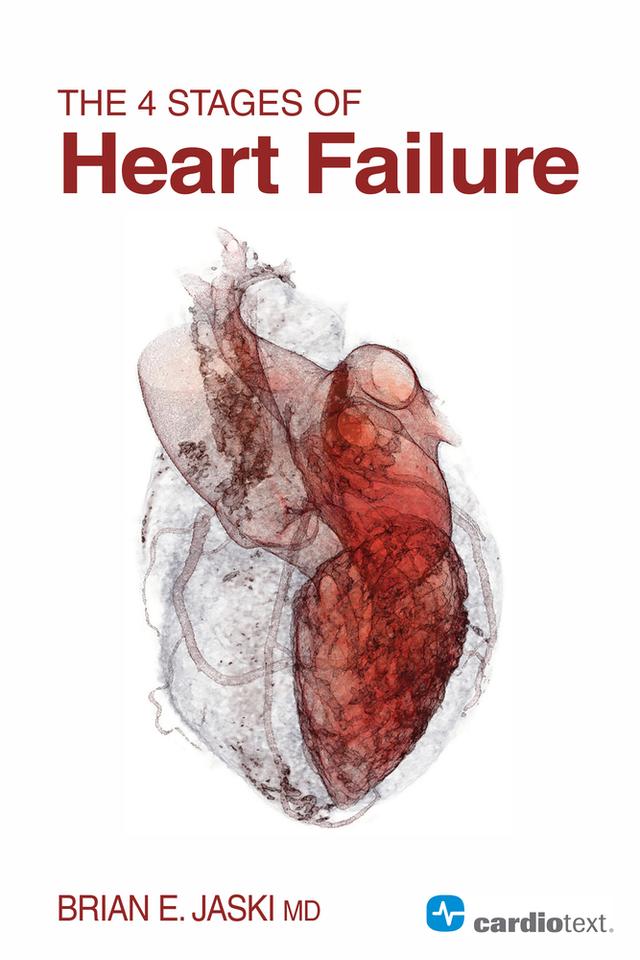 The 4 Stages of Heart Failure by Brian Jaski