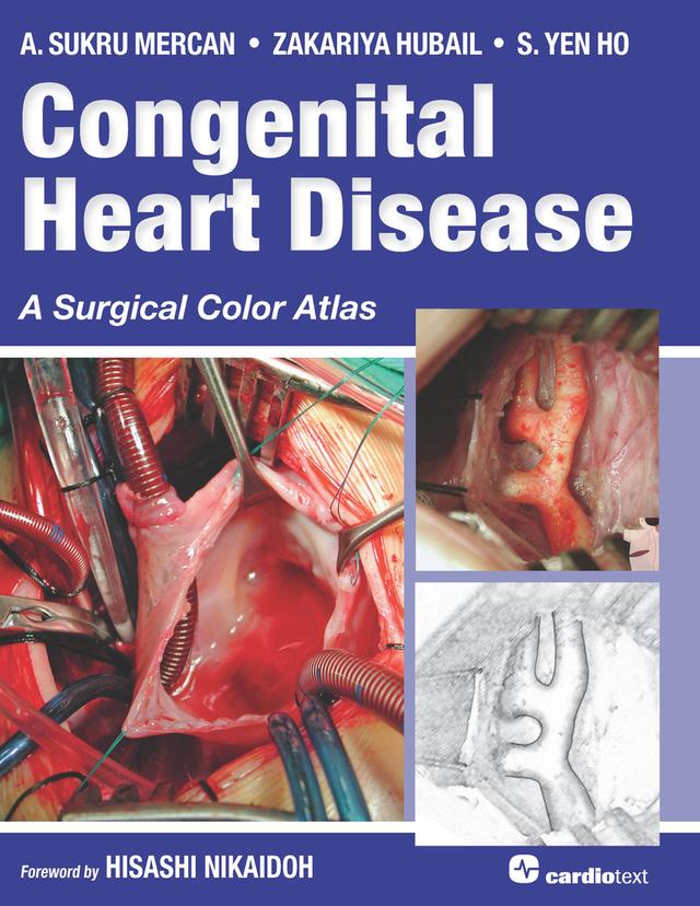 Congenital Heart Disease: A Surgical Color Atlas by A. Sukru Mercan, S. Yen Ho, Zakariya Hubail