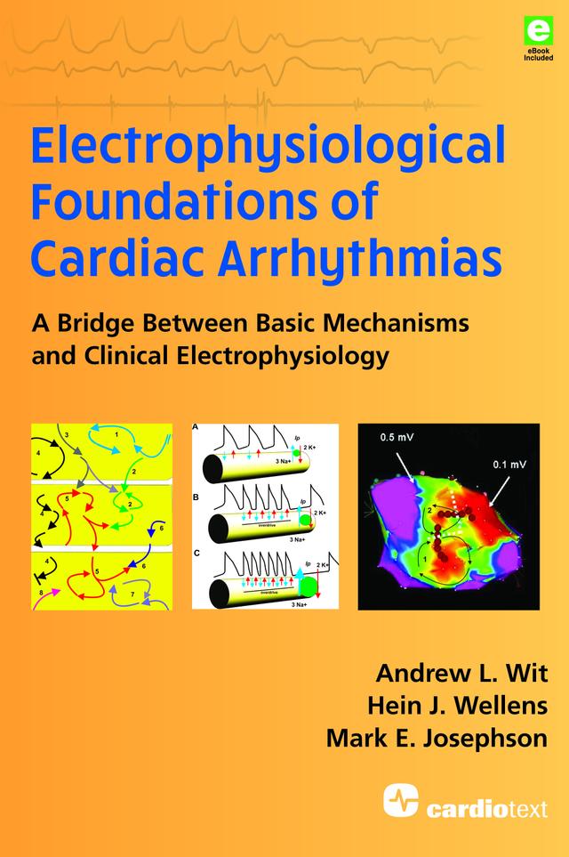 Electrophysiological Foundations of Cardiac Arrhythmias by Andrew L. Wit, Hein J. Wellens, Mark E. Josephson