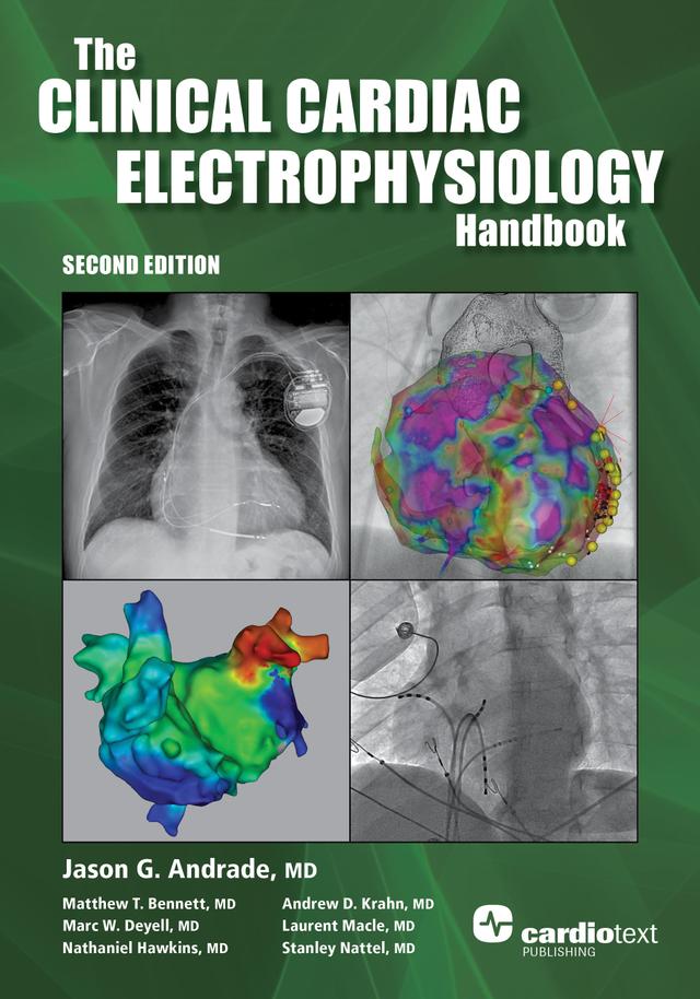 The Clinical Cardiac Electrophysiology Handbook, Second Edition by Jason Andrade