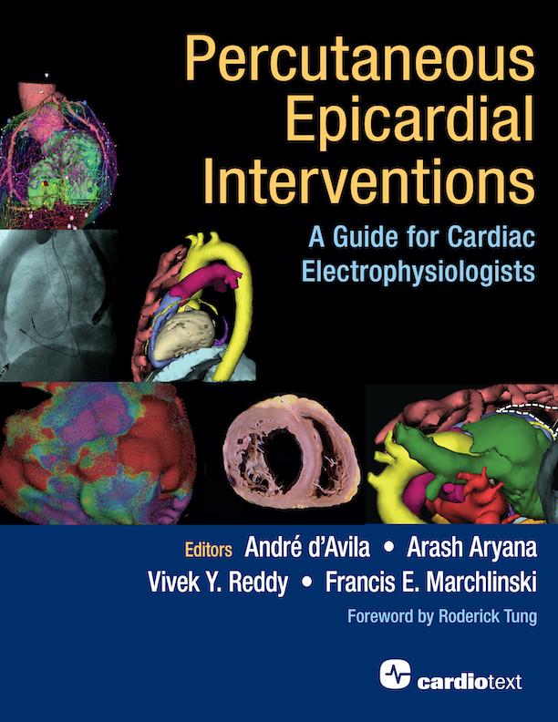Percutaneous Epicardial Interventions by Andre d'Avila, Arash Aryana, Francis E. Marchlinski, Vivek Y. Reddy
