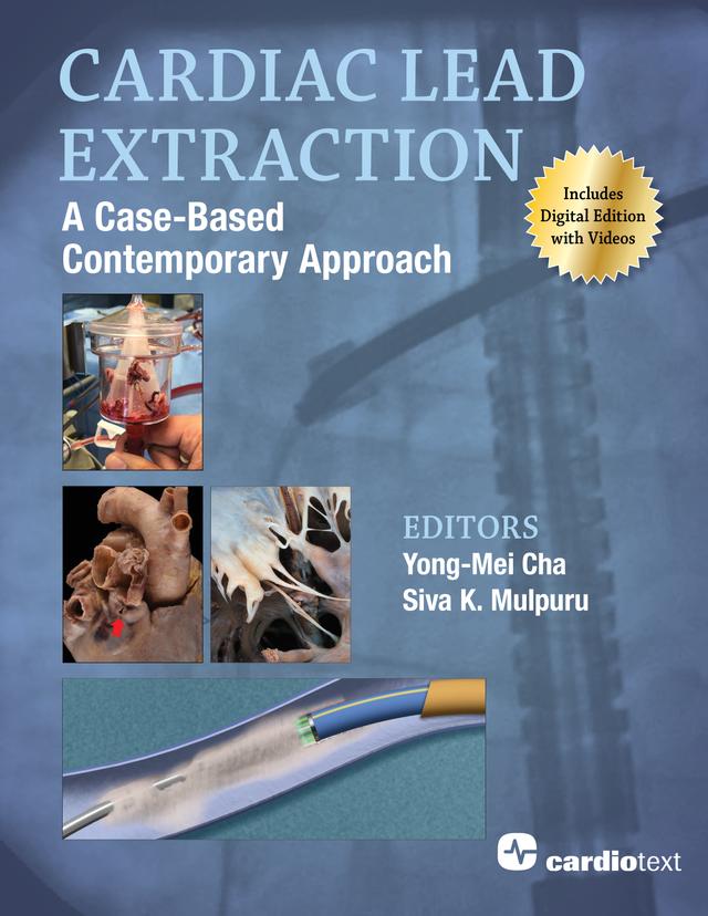 Cardiac Lead Extraction: A Case-Based Contemporary Approach by Siva K. Mulpuru, Yong-Mei Cha