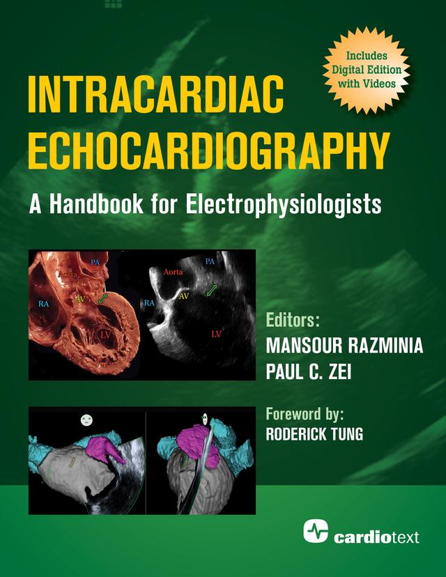 Intracardiac Echocardiography: A Handbook for Electrophysiologists by Mansour Razminia, Paul C. Zei