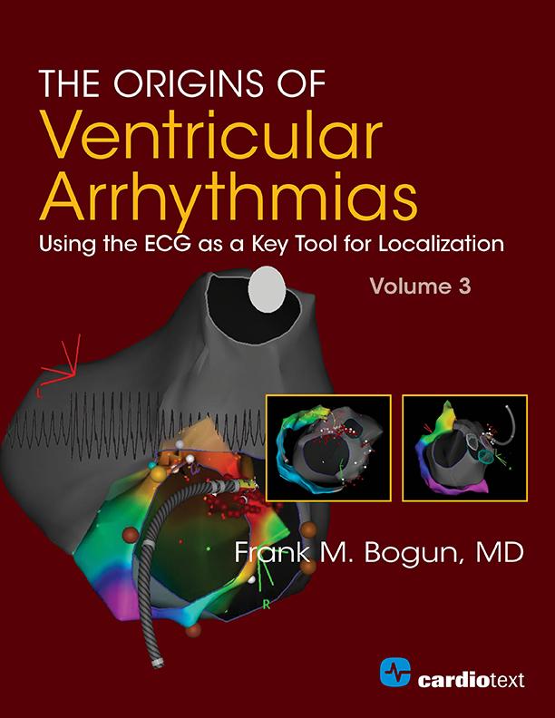 The Origins of Ventricular Arrhythmias: Using the ECG as a Key Tool for Localization, Volume 3 by Frank M. Bogun