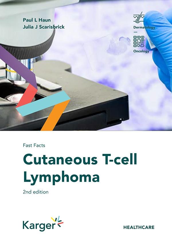Fast Facts: Cutaneous T-cell Lymphoma