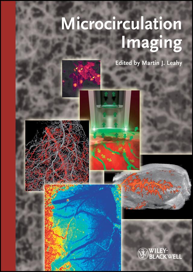 Microcirculation Imaging by Martin J. Leahy