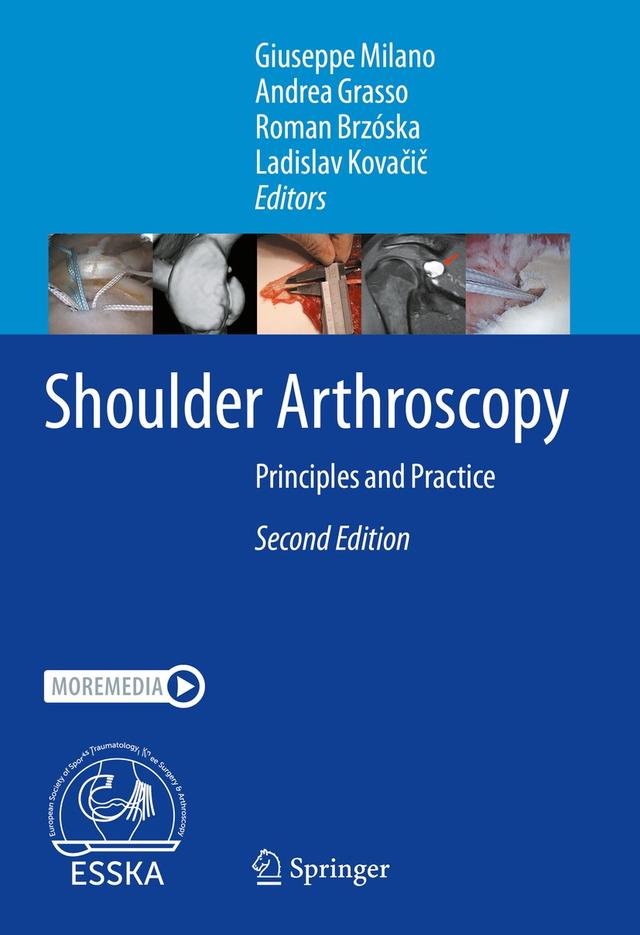 Shoulder Arthroscopy by Andrea Grasso, Giuseppe Milano, Ladislav Kovačič, Roman Brzóska