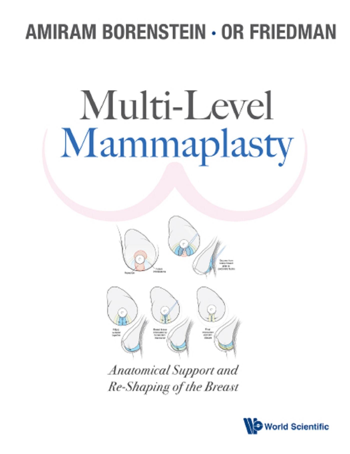 MULTI-LEVEL MAMMAPLASTY