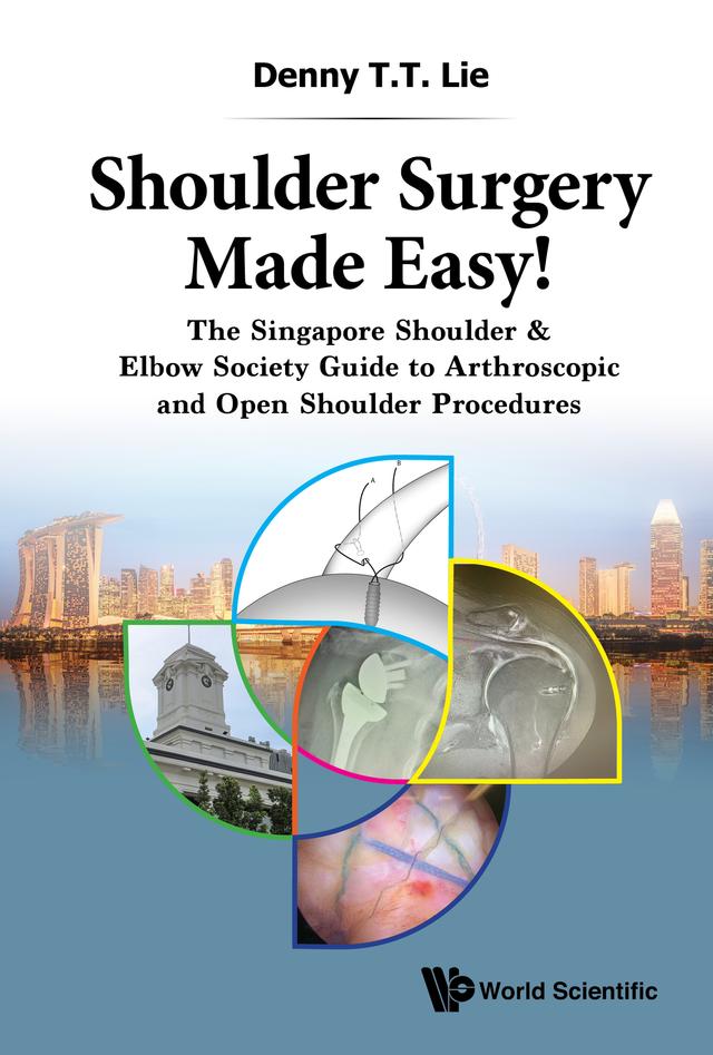 SHOULDER SURGERY MADE EASY! by Denny T T Lie