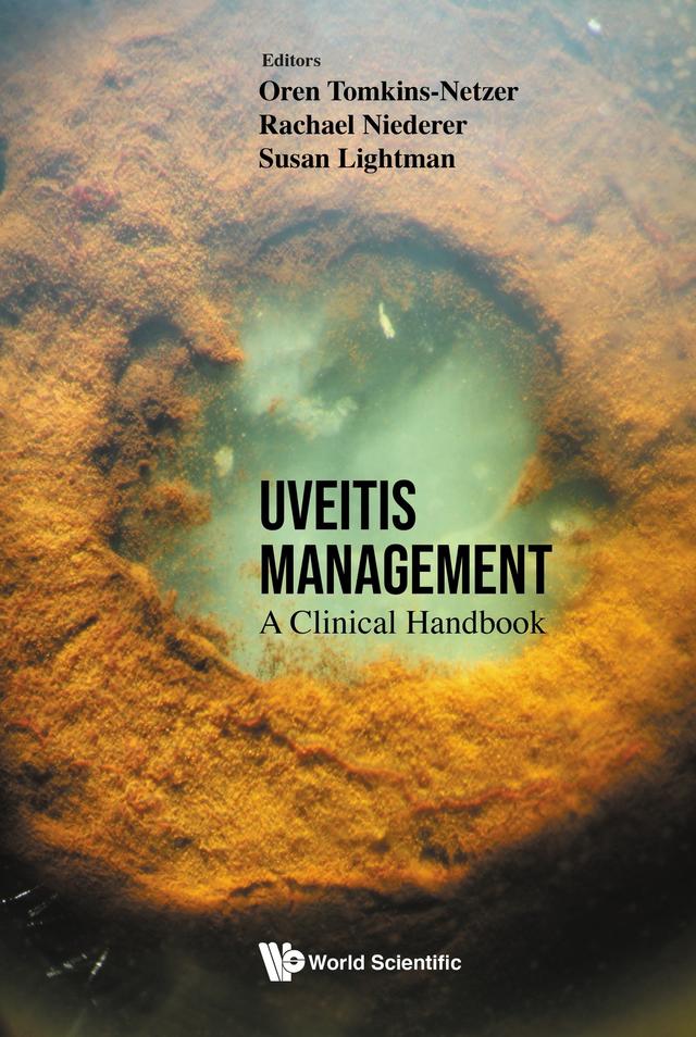 UVEITIS MANAGEMENT: A CLINICAL HANDBOOK by Oren Tomkins-Netzer, Rachael Niederer, Susan Lightman