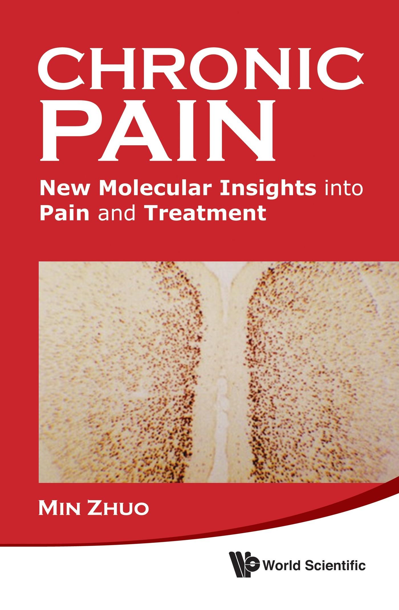 CHRONIC PAIN