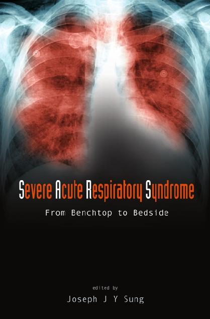 SEVERE ACUTE RESPIRATORY SYNDROME